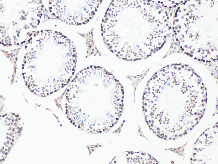 Bcl9 Rabbit polyclonal antibody