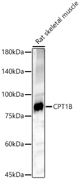 CPT1B Rabbit polyclonal antibody
