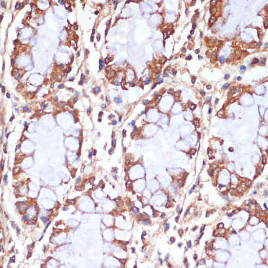 CPT1B Rabbit polyclonal antibody