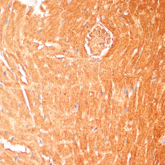 CPT1B Rabbit polyclonal antibody
