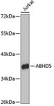 Western blot - ABHD5 Rabbit pAb (A6801)