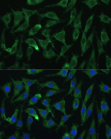 Argonaute-2 Rabbit polyclonal antibody