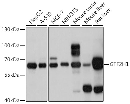 GTF2H1 Rabbit polyclonal antibody
