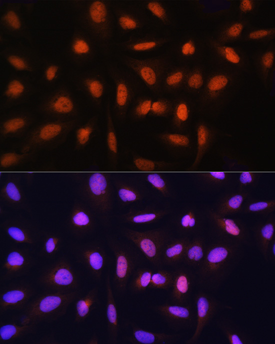 GTF2H1 Rabbit polyclonal antibody