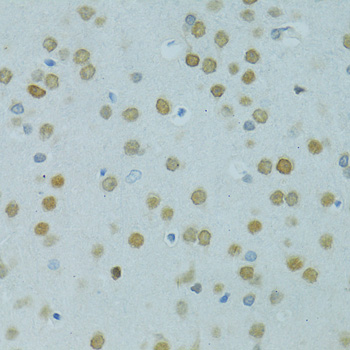 MUS81 Rabbit polyclonal antibody