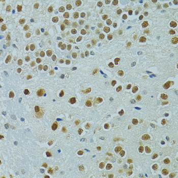 MUS81 Rabbit polyclonal antibody