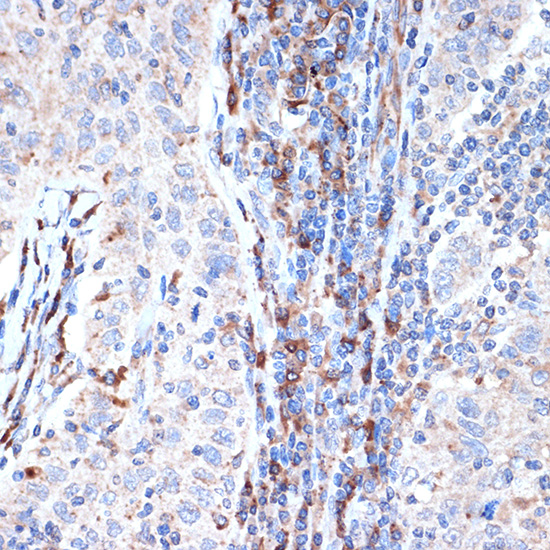 DCP1A Rabbit monoclonal antibody