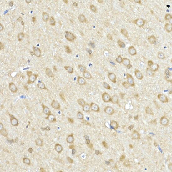 ACSL4 Rabbit polyclonal antibody