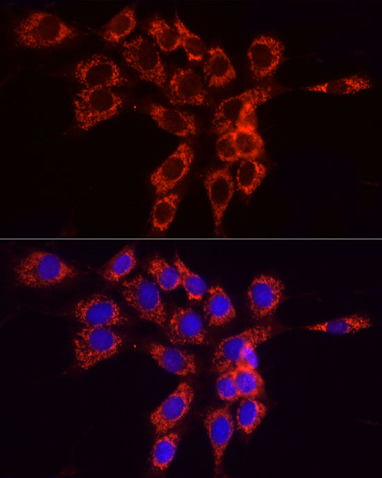 ACSL4 Rabbit polyclonal antibody