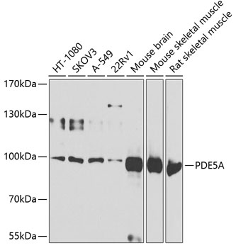 Western blot analysis of various lysates using PDE5A Rabbit pAb (A6831) at 1:1000 dilution.<br/>Secondary antibody: HRP Goat Anti-Rabbit IgG (H+L) (AS014) at 1:10000 dilution.<br/>Lysates/proteins: 25μg per lane.<br/>Blocking buffer: 3% nonfat dry milk in TBST.<br/>Detection: ECL Basic Kit (RM00020).<br/>Exposure time: 60s.