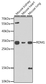 Western blot analysis of various lysates using RDM1 Rabbit pAb (A6845) at 1:1000 dilution.<br/>Secondary antibody: HRP Goat Anti-Rabbit IgG (H+L) (AS014) at 1:10000 dilution.<br/>Lysates/proteins: 25μg per lane.<br/>Blocking buffer: 3% nonfat dry milk in TBST.<br/>Detection: ECL Basic Kit (RM00020).<br/>Exposure time: 90s.