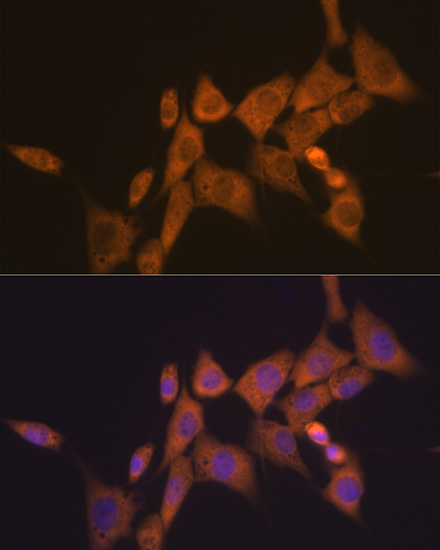 ATG10 Rabbit monoclonal antibody