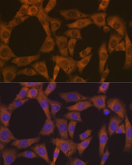 CAD Rabbit monoclonal antibody