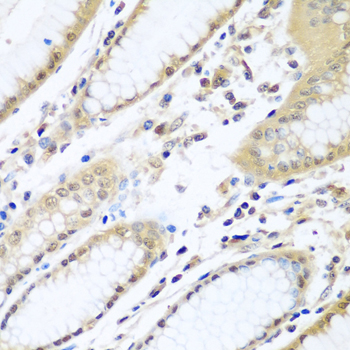 WDR48 Rabbit polyclonal antibody