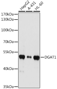 DGAT1 Rabbit polyclonal antibody