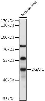 DGAT1 Rabbit polyclonal antibody