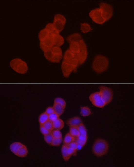DGAT1 Rabbit polyclonal antibody