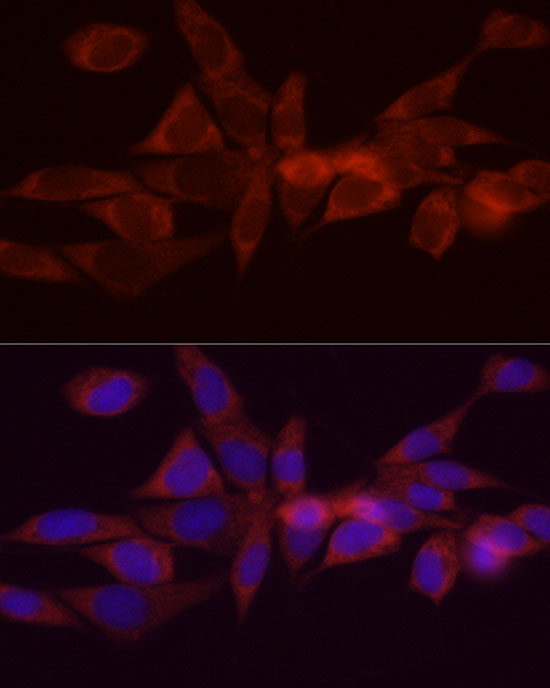 DGAT1 Rabbit polyclonal antibody
