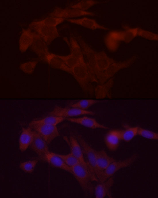 DGAT1 Rabbit polyclonal antibody