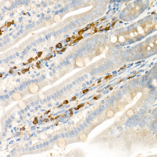 ALOX15 Rabbit polyclonal antibody