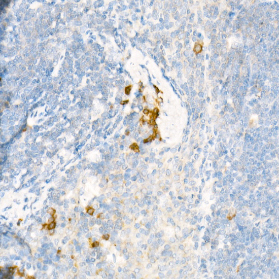 ALOX15 Rabbit polyclonal antibody
