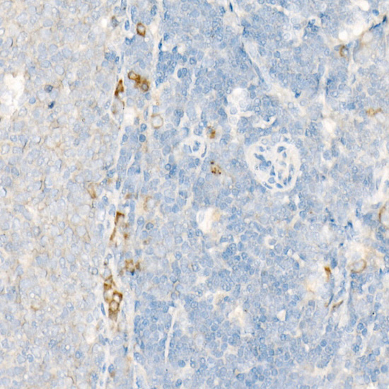 ALOX15 Rabbit polyclonal antibody