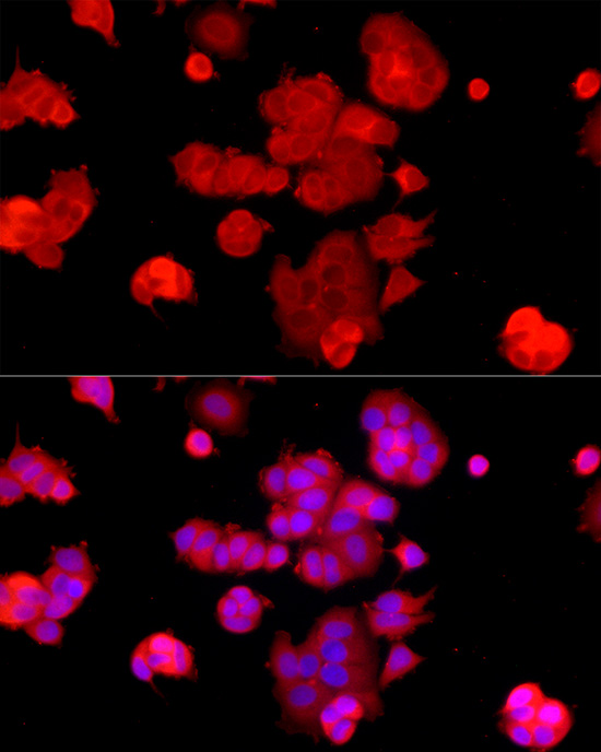 ALOX15 Rabbit polyclonal antibody