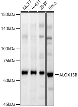 ALOX15B Rabbit polyclonal antibody