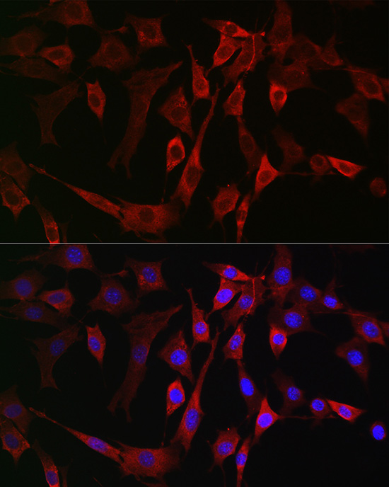 ALOX15B Rabbit polyclonal antibody