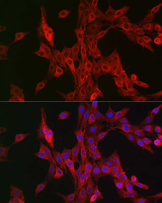 ALOX15B Rabbit polyclonal antibody