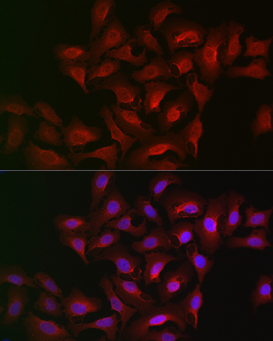 ALOX15B Rabbit polyclonal antibody