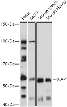 [KO Validated] XIAP Rabbit polyclonal antibody
