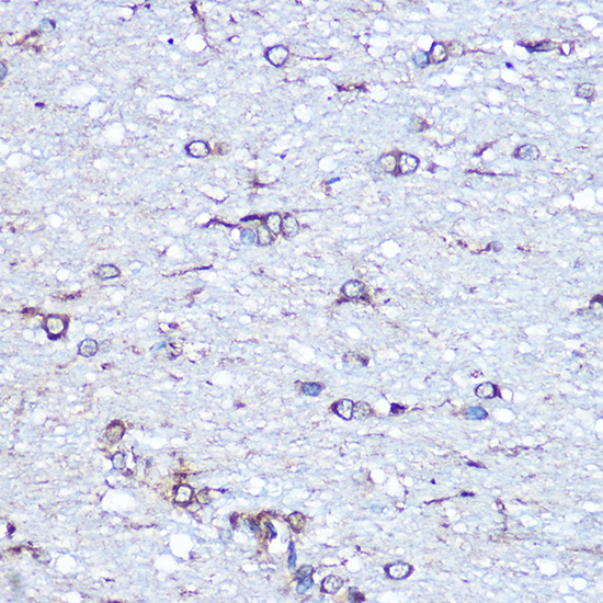 APLP1 Rabbit polyclonal antibody