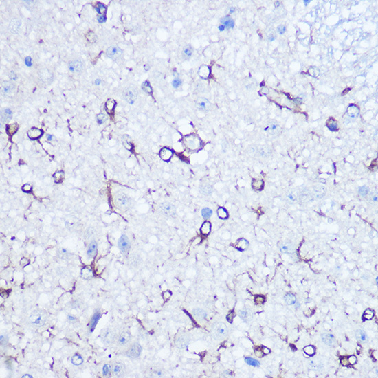 APLP1 Rabbit polyclonal antibody