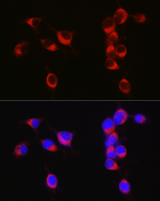 APLP1 Rabbit polyclonal antibody