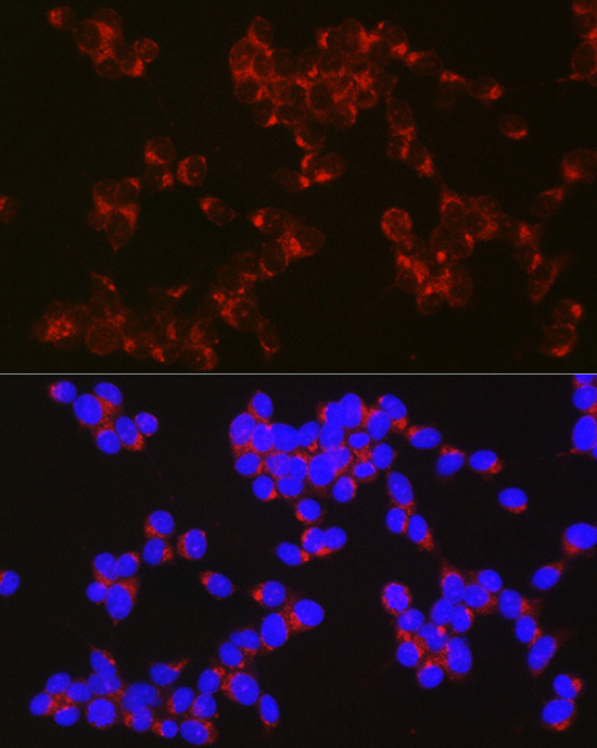 APLP1 Rabbit polyclonal antibody