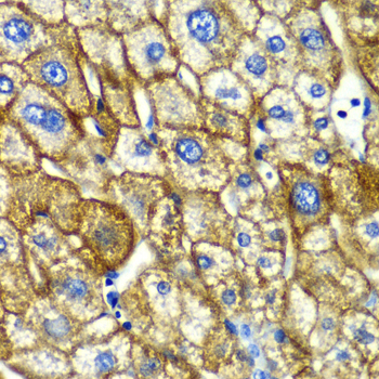 ASGR1 Rabbit polyclonal antibody
