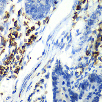 ASGR1 Rabbit polyclonal antibody
