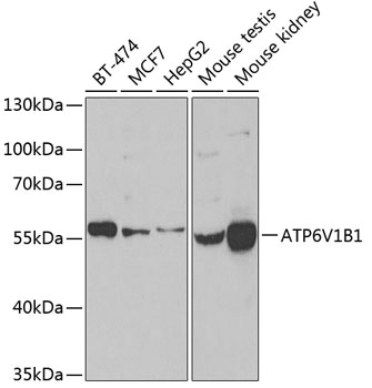 ATP6V1B1 Rabbit polyclonal antibody