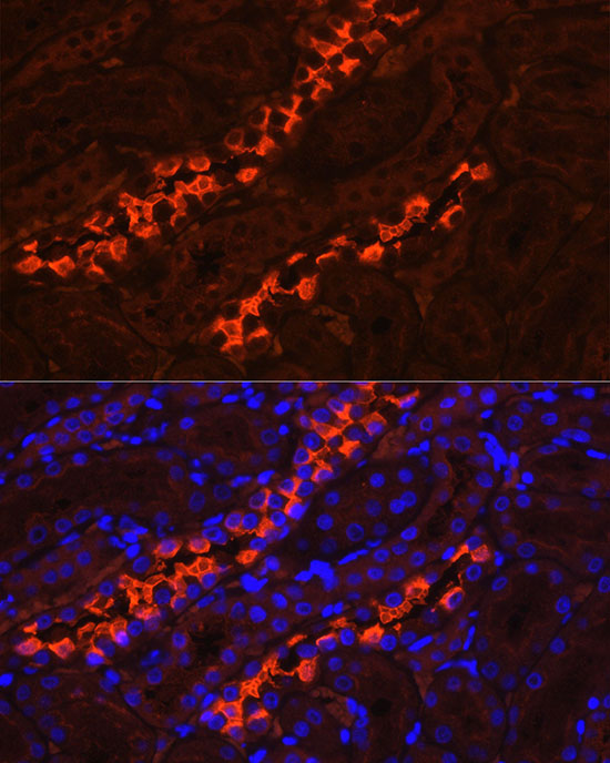 ATP6V1B1 Rabbit polyclonal antibody