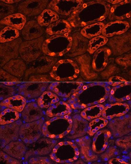 ATP6V1B1 Rabbit polyclonal antibody