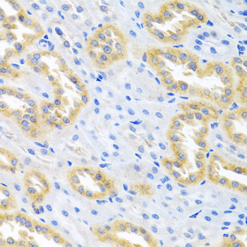 BMP3 Rabbit polyclonal antibody