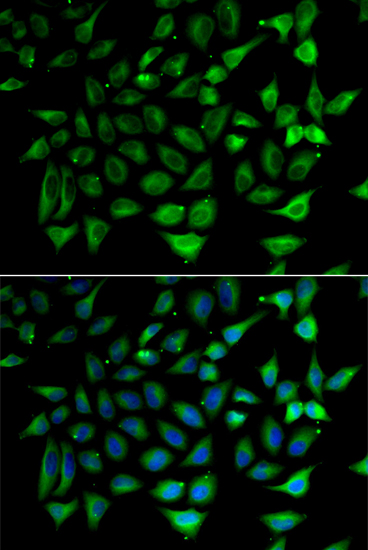 SLC25A20 Rabbit polyclonal antibody