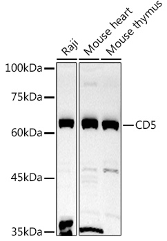CD5 Rabbit polyclonal antibody