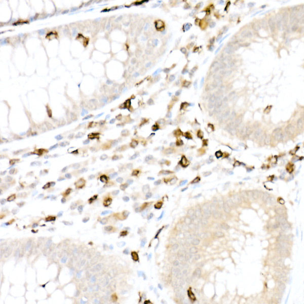 CD5 Rabbit polyclonal antibody