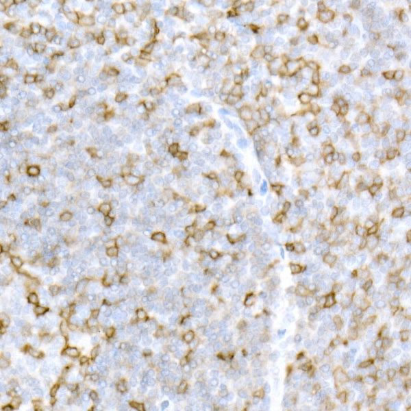 CD5 Rabbit polyclonal antibody