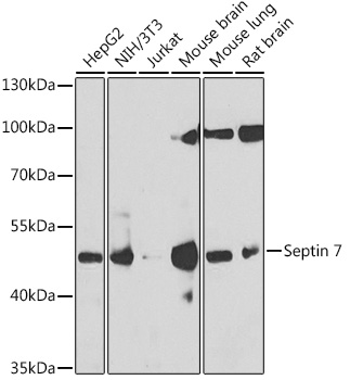 Septin 7 Rabbit polyclonal antibody
