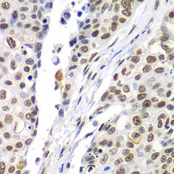 Septin 7 Rabbit polyclonal antibody