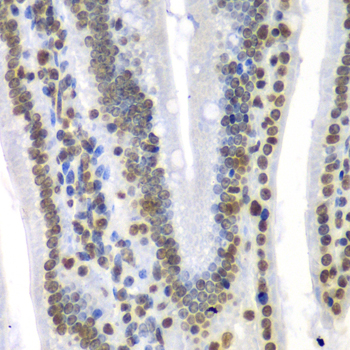 Septin 7 Rabbit polyclonal antibody