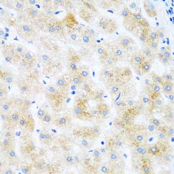 DHODH Rabbit polyclonal antibody